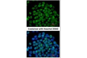 ICC/IF Image Immunofluorescence analysis of paraformaldehyde-fixed mouse ESC D3, using KLF5, antibody at 1:200 dilution.