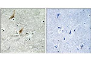 Immunohistochemistry analysis of paraffin-embedded human brain tissue using MSK2 (Phospho-Thr568) antibody.