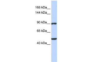 WB Suggested Anti-ZNF217 Antibody Titration:  0. (ZNF217 anticorps  (Middle Region))