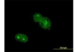 Immunofluorescence of purified MaxPab antibody to ZNF32 on Hs 181. (ZNF32 anticorps  (AA 1-273))