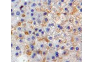 Used in DAB staining on fromalin fixed paraffin-embedded Liver tissue (Selectin E/CD62e anticorps  (AA 108-238))