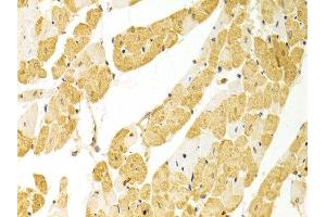 Immunohistochemistry of paraffin-embedded rat heart using PLCB1 antibody at dilution of 1:100 (x400 lens). (Phospholipase C beta 1 anticorps)