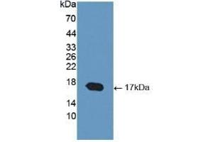 Detection of Recombinant COMP, Human using Polyclonal Antibody to Cartilage Oligomeric Matrix Protein (COMP) (COMP anticorps  (AA 123-240))