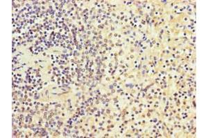 Immunohistochemistry of paraffin-embedded human spleen tissue using ABIN7168570 at dilution of 1:100 (SGF29 anticorps  (AA 1-293))