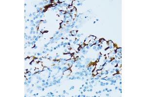 Immunohistochemistry of paraffin-embedded human tonsil using CTSE antibody (ABIN5971444) at dilution of 1/100 (40x lens). (Cathepsin E anticorps)