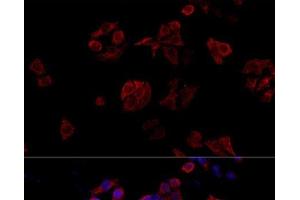 Immunofluorescence analysis of HeLa cells using CD40L Polyclonal Antibody at dilution of 1:100.
