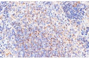 Immunohistochemistry of paraffin-embedded Rat spleen using PDGFR beta Polyclonal Antibody at dilution of 1:100 (40x lens). (PDGFRB anticorps)
