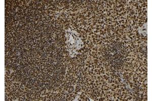 ABIN6277088 at 1/100 staining Mouse spleen tissue by IHC-P. (Progesterone Receptor anticorps  (Internal Region))