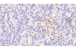 Detection of PTPRN in Human Pancreas Tissue using Polyclonal Antibody to Protein Tyrosine Phosphatase Receptor Type N (PTPRN)