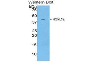 Western Blotting (WB) image for anti-Interleukin 12 Receptor, beta 2 (IL12RB2) (AA 559-647) antibody (ABIN3207281) (IL12RB2 anticorps  (AA 559-647))