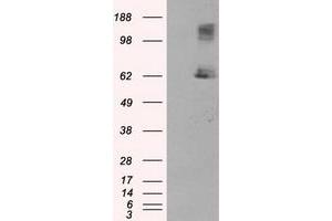 Image no. 5 for anti-Lipase, Endothelial (LIPG) antibody (ABIN1499166) (LIPG anticorps)