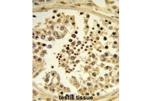 Immunohistochemistry (IHC) image for anti-Importin 11 (IPO11) antibody (ABIN3003903)