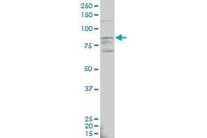 ALDH18A1 monoclonal antibody (M01), clone 2B5 Western Blot analysis of ALDH18A1 expression in MCF-7 .