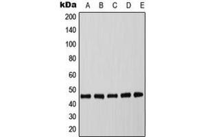 Western blot analysis of C/EBP alpha (pT226) expression in MCF7 EGF-treated (A), mouse spleen (B), mouse liver (C), rat spleen (D), rat liver (E) whole cell lysates. (CEBPA anticorps  (pSer226))
