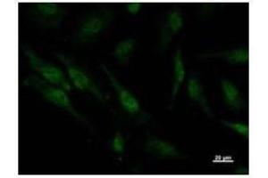 Immunostaining analysis in HeLa cells.