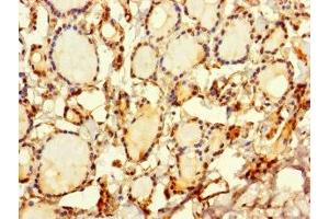 Immunohistochemistry of paraffin-embedded human thyroid tissue using ABIN7169648 at dilution of 1:100