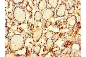 Immunohistochemistry of paraffin-embedded human thyroid tissue using ABIN7169648 at dilution of 1:100 (SRP19 anticorps  (AA 2-144))