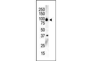 Western blot analysis of anti-PKCnu C-term Pab in NCI-H460 cell lysate. (PRKD3 anticorps  (C-Term))