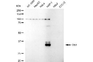 Western blotting analysis using Otx1 antibody (ABIN7799708).