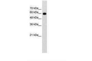Image no. 1 for anti-Cell Division Cycle 23 (CDC23) (AA 101-150) antibody (ABIN203478) (CDC23 anticorps  (AA 101-150))