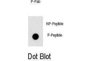 Dot blot analysis of anti-Phospho-ZBTB16-p Antibody (ABIN389958 and ABIN2839759) on nitrocellulose membrane. (ZBTB16 anticorps  (pTyr334))