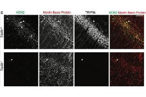 Immunohistochemistry of the cell body layer of CA1 of Trip8b+/+ and Trip8b-/- mice showing specific lableling of HCN2, Myelin Basic Protein, and TRIP8b (cat.