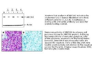 Immunohistochemistry (IHC) image for anti-ATP-Binding Cassette, Sub-Family A (ABC1), Member 1 (ABCA1) antibody (ABIN187475) (ABCA1 anticorps)