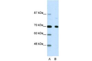 WB Suggested Anti-NCOR2  Antibody Titration: 2. (NCOR2 anticorps  (N-Term))