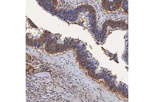 IHC analysis of SBP/SELENBP1 using anti-SBP/SELENBP1 antibody (ABIN7600755). (SELENBP1 anticorps  (AA 23-462))