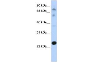 WB Suggested Anti-CHIC2 Antibody Titration: 0. (CHIC2 anticorps  (N-Term))