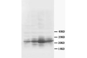 Western Blotting (WB) image for anti-Growth Associated Protein 43 (GAP43) antibody (ABIN1107311) (GAP43 anticorps)