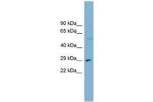 WB Suggested Anti-DNASE1  Antibody Titration: 0. (DNASE1 anticorps  (N-Term))