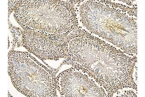 ABIN7095262 and ABIN7099319 at 1/100 staining rat testis tissue by IHC-P. (ZFR anticorps)