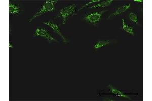 Immunofluorescence of purified MaxPab antibody to DLST on HeLa cell.