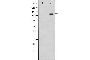 Western blot analysis of Retinoblastoma phosphorylation expression in serum treated K562 whole cell lysates,The lane on the left is treated with the antigen-specific peptide. (Retinoblastoma 1 anticorps  (pSer795))