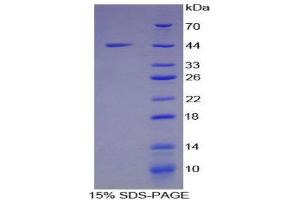 SDS-PAGE (SDS) image for Mucin 5 Subtype B (MUC5B) (AA 3667-3771) protein (His tag,GST tag) (ABIN1878876)