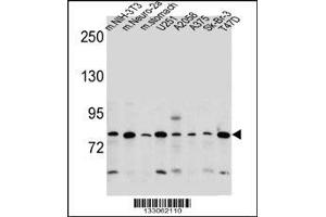 Western blot analysis in mouse NIH-3T3,Neuro-2a cell line and mouse stomach tissue and U251,A2058,A375,Sk-Br-3,T47D cell line lysates (35ug/lane). (DCBLD2 anticorps  (C-Term))