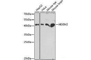Western blot analysis of extracts of various cell lines using HEXIM2 Polyclonal Antibody at dilution of 1:1000. (HEXIM2 anticorps)