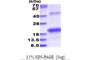 SDS-PAGE (SDS) image for Hepatitis C Virus Envelope Protein E2 (HCV E2) (AA 2634-2752) protein (His tag) (ABIN5853698)