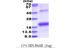 SDS-PAGE (SDS) image for Hepatitis C Virus NS5b (HCV NS5b) (AA 2634-2752) protein (His tag) (ABIN5853698) (HCV 1b NS5B Protein (AA 2634-2752) (His tag))