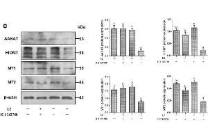 Effect of E2 and ER antagonist ICI182780 on melatonin production and the expression of AANAT, HIOMT, MT1, and MT2 mRNA and protein in sheep COCs.