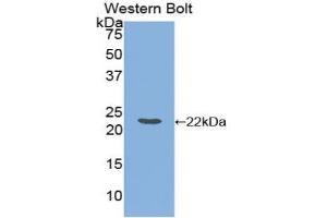 Detection of Recombinant FTL, Equine using Polyclonal Antibody to Ferritin, Light Polypeptide (FTL)