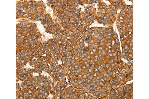 Immunohistochemistry (IHC) image for anti-Secreted Frizzled-Related Protein 1 (SFRP1) antibody (ABIN2432271) (SFRP1 anticorps)