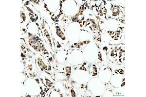 IHC analysis of IRF9 using anti-IRF9 antibody (ABIN4886637).