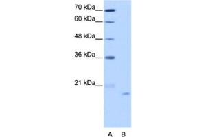 Western Blotting (WB) image for anti-Nucleolar Protein 6 (NOL6) antibody (ABIN2462296) (Nucleolar Protein 6 anticorps)