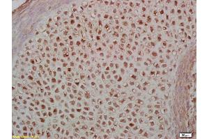 Formalin-fixed and paraffin embedded mouse embryo labeled with Rabbit Anti Phospho-MEF2A (Thr312) Polyclonal Antibody, Unconjugated (ABIN743768) at 1:200 followed by conjugation to the secondary antibody and DAB staining (MEF2A anticorps  (pThr312))