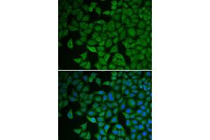 Immunofluorescence analysis of HeLa cells using CHEK2 antibody.