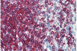 Human Spleen: Formalin-Fixed, Paraffin-Embedded (FFPE)