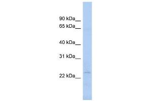 NAT9 antibody used at 1 ug/ml to detect target protein. (NAT9 anticorps)