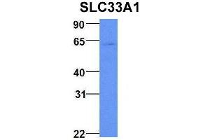 Host:  Rabbit  Target Name:  NOP56  Sample Type:  Human Fetal Brain  Antibody Dilution:  1.